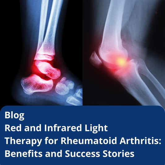 Red and Infrared Light Therapy for Rheumatoid Arthritis: Benefits and Success Stories